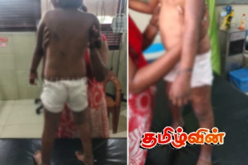 மட்டக்களப்பில் ஐந்து வயது சிறுமிக்கு நடந்த சித்திரவதை.. தாயின் காதலனின் மோசமான செயல்