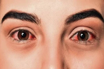 மக்களே அபாயம்; கண்களில் ரத்தம் வழிய..வழிய.. கொல்லும் வைரஸ் - இந்த அறிகுறிகள் இருக்கா?