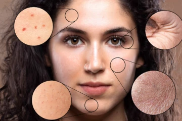 அனைத்து விதமான சரும பிரச்சனைக்கும் உடனடி தீர்வு தரும் பேஸ் மாஸ்க்.. எப்படி செய்வது?