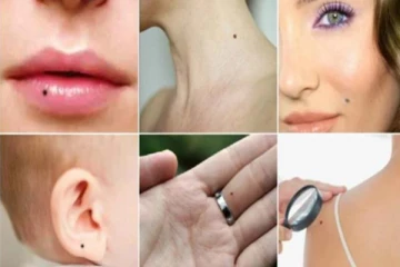 இந்த இடத்தில் மச்சம் இருந்தால் ராஜ யோகமாம்! வாழ்நாள் முழுவதும் பணக்கஷ்டமே வராதாம்