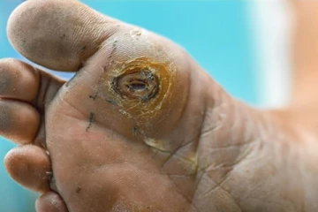 மரணத்திற்கு அழைத்து செல்லும் கொலஸ்ட்ரால் பிரச்சனை! இவ்வளவு ஆபத்தா?