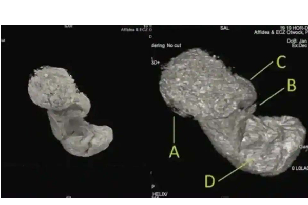 முதல் கர்ப்பிணி மம்மி: வயிற்றில் சிதையாமல் காணப்பட்ட கரு: ஆச்சரியத்தில் விஞ்ஞானிகள் | Safe Embryo Found In Egyptian Mummys Stomach