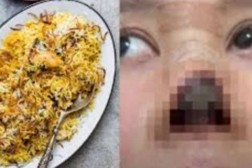 20,000 ரூபாய்க்கு ஒரு plate பிரியாணியா? அறுவை சிகிச்சையால் சூனியக்காரி போல மாறிய அழகியின் முகம் (வினோத உலகம்)