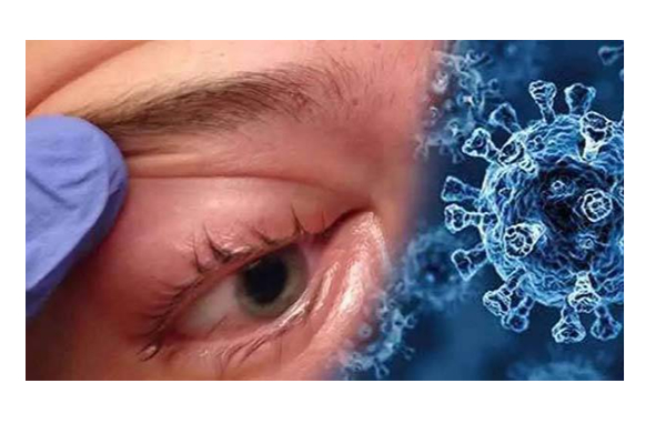 கருப்பு பூஞ்சை நோய் எதனால் ஏற்படுகிறது? அறிகுறியும் தடுக்கும் வழிமுறைகளும்; | Black Fungus Symptoms In Tamil