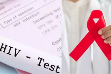 கடந்த வருடம் 40 சிறுவர்கள் எச்.ஐ.வி. தொற்றினால் பாதிப்பு