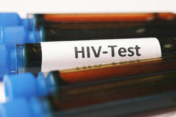 HIV HIV