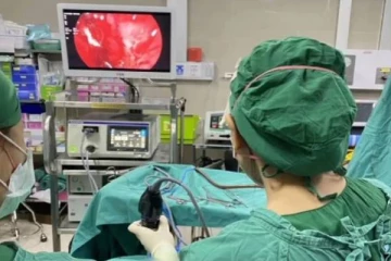 பெண்ணின் மூக்கில் இருந்து திடீரென ரத்த கசிவு... பரிசோதனையில் அதிர்ச்சியடைந்த மருத்துவர்கள்