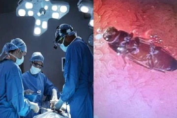 3 நாட்களாக வயிற்றுக்குள் உயிருடன் இருந்த கரப்பான் பூச்சி ; 10 நிமிடத்தில் இளைஞரை காப்பாற்றிய மருத்துவர்கள்