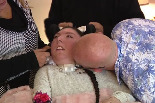 මොළයේ 90%ක් නැති තරුණියක් 20 වැනි උපන්දිනය සමරයි | Young Woman Missing 90 Of Brain Turns 20