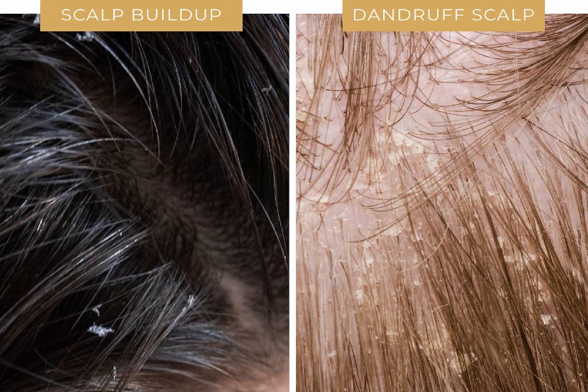 இரவில் உறங்கும் முன் தலைக்கு மறந்தும் எண்ணெய் வைக்காதீங்க! மீறினால் இந்த பிரச்சனை வரும் | Hair Care Tips Does Putting Oil On Your Hair Night