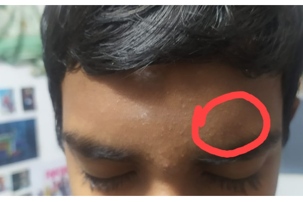 ஆசிரியரின் தாக்குதலில் மாணவனின் செவிப்பறை கிழிந்தது | Teacher Assaults Student