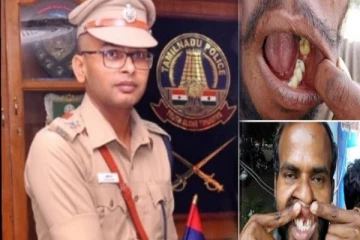 கைதிகளின் பற்கள் பிடுங்கப்பட்ட விவகாரம்; பல்டி அடித்த குற்றவாளி சூர்யா - என்ன காரணம்?