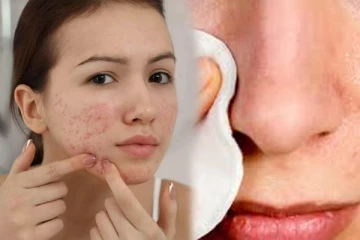 மூக்கில் அதிகமா கரும்புள்ளி இருக்கா? இனிமேல் இப்படி பண்ணுங்க...