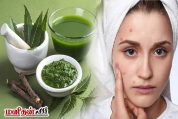 முகப்பருக்களை ஒரே இரவில் மாயமாக்கும் ஃபேஸ் பேக்! எப்படி தயாரிப்பது?