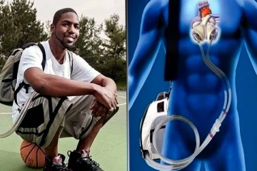 555 நாட்கள் இதயம் இல்லாமல் வாழ்ந்த இளைஞர்.. மருத்துவத்திற்கு சவால் விட்ட சாதனை- யார் இவர்?