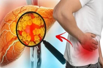 கல்லீரல் நோய் இருப்பதை எச்சரிக்கும் 6 அறிகுறிகள்.., என்னென்ன தெரியுமா?