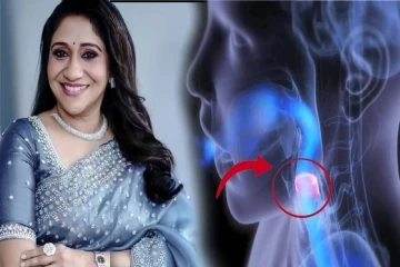 பாடகி சுஜாவிற்கு தொண்டையில் என்ன பிரச்சனை? இதை குணப்படுத்த முடியுமா?