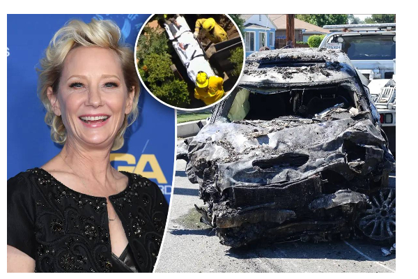 கார் விபத்தில் சிக்கி சிகிச்சை பலனின்றி உயிரிழந்த பிரபல நடிகை! சோகத்தில் திரையுலகினர்கள் | Famous Actress Anne Heche Death By Car Accident