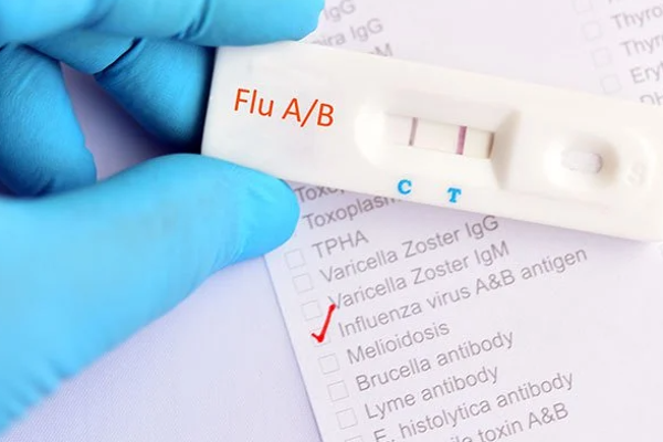 இலங்கையில் வேகமெடுக்கும் புதிய வைரஸ்; 14 பேர் பலி | New Virus Accelerating In Sri Lanka 14 People