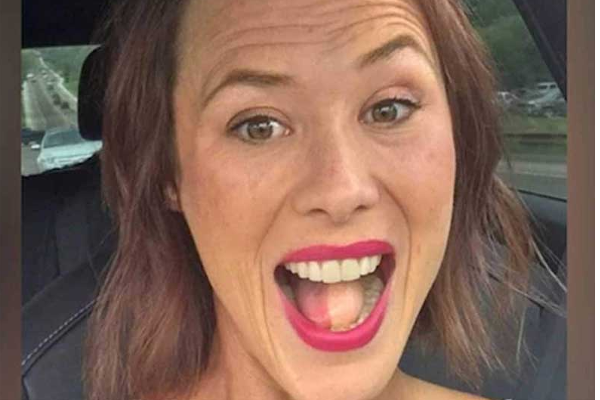 புற்றுநோய் பாதித்த பெண்ணுக்கு நாக்கில் முடி வளர்ந்த சம்பவம் - அதிர்ச்சியடைந்த மருத்துவர்கள் - தமிழ்நாடு