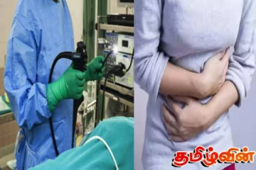 அறிகுறிகள் தென்பட்டால் உடனடியாக மருத்துவ ஆலோசனை பெறவும்! விடுக்கப்பட்டுள்ள எச்சரிக்கை