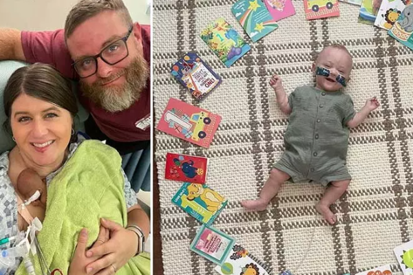 பிறந்த உடனே கின்னஸ் சாதனை படைத்த குழந்தை | Premature Baby Break New Guinness World Record