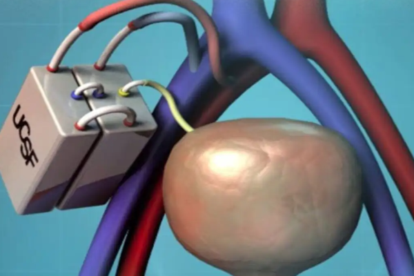 செயற்கை சிறுநீரகத்தை உருவாக்கிய விஞ்ஞானிகள் | Scientists Create Artificial Kidney