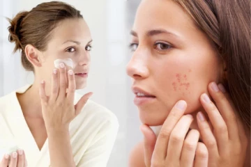 முகத்தில் உள்ள கரும்புள்ளியை நீக்க இந்த 2 பொருள் போதும்: எப்படி பயன்படுத்துவது?