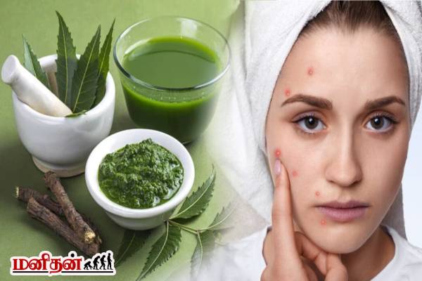 முகப்பருக்களை ஒரே இரவில் மாயமாக்கும் ஃபேஸ் பேக்! எப்படி தயாரிப்பது? | How To Prepare Neem Face Mask For Glowing Skin