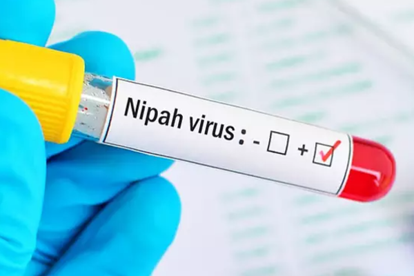 நிபா வைரஸின் தீவிரம்: வெளிநாடு செல்லும் இலங்கையர்களுக்கும் எச்சரிக்கை | Nipa Virus In Sri Lanka
