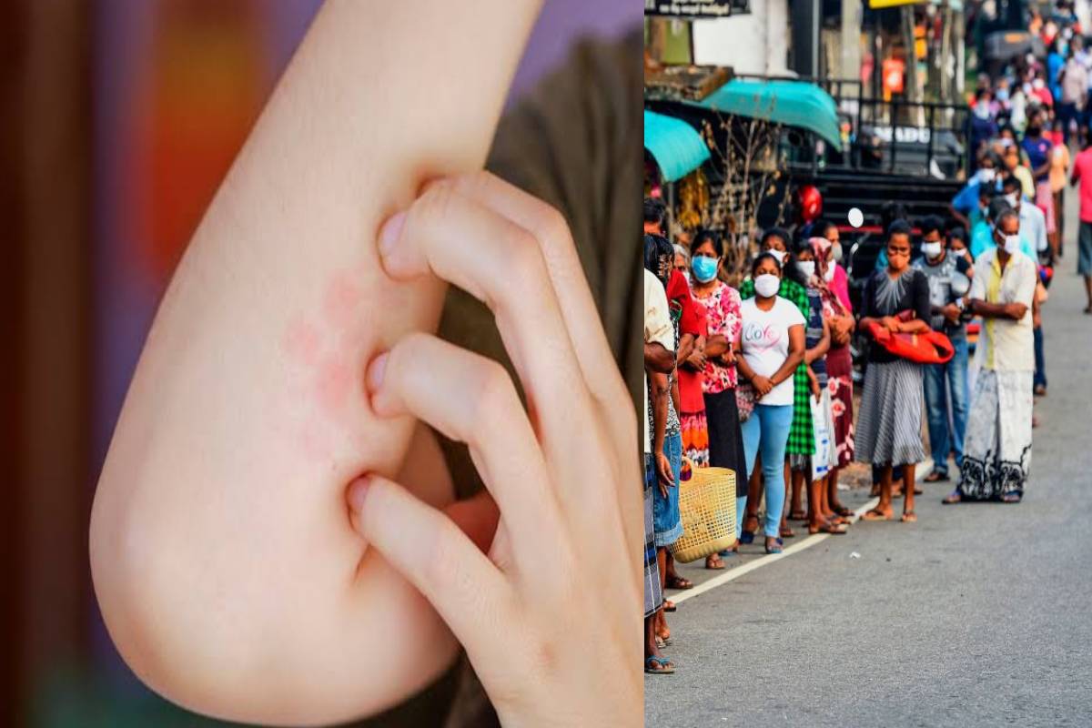 டெங்கு நோயாளிகளுக்கு பெரும் அச்சுறுத்தலாக மாறியுள்ள புதிய வைரஸ் தொற்று! விடுக்கப்பட்டுள்ள எச்சரிக்கை | New Virus In More Dengue Patients டெங்கு நோயாளிகளுக்கு பெரும் அச்சுறுத்தலாக மாறியுள்ள புதிய வைரஸ் தொற்று! விடுக்கப்பட்டுள்ள எச்சரிக்கை | New Virus In More Dengue Patients