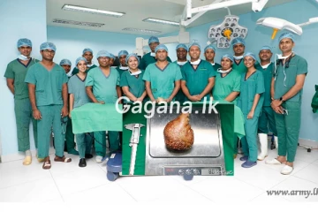 ශ්රී ලංකා යුද හමුදා වෛද්යවරු ගිනස් ලෝක වාර්තාවක් තබයි..ප්රථම වරට මෙරටින් ආරංචි වූදේ.(PHOTOS)