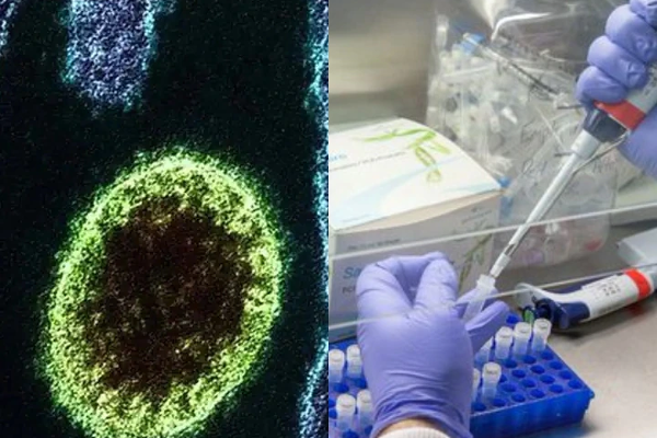 சீனாவில் பரபரப்பை ஏற்படுத்திய மற்றுமொரு வைரஸ்! | Another Virus That Caused Excitement In China