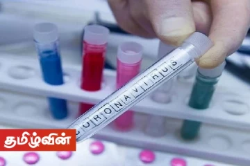 பருத்தித்துறையைச் சேர்ந்த 9 வயது மாணவிக்கு கோவிட் தொற்று