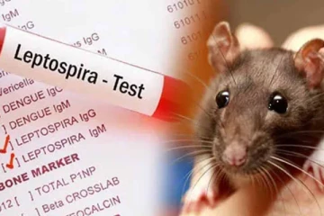 யாழில் பரவும் எலிக்காய்ச்சல் ; மக்களுக்கு விடுத்துள்ள எச்சரிக்கை