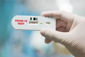 யாழ்.சங்கானையில் பிரதேச செயலர், கிராமசேவகர் உட்பட 29 பேருக்கு கொரோனா