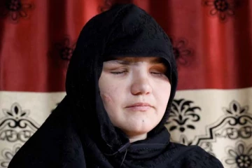 நாய்களுக்கு விருந்தாகும் பெண்கள்: அன்று தாலிபான்களால் 8 முறை சுடப்பட்ட கர்ப்பிணி! பகீர் உண்மை