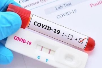 திருநெல்வேலியில் 22 பேர் உட்பட யாழில் 24 பேருக்கு கோவிட் தொற்று உறுதி