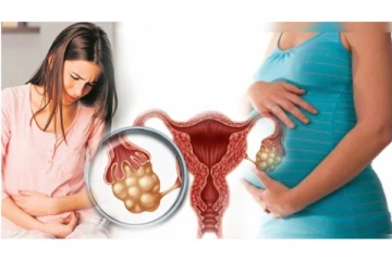 கர்ப்பப்பை நீர்க்கட்டி வர காரணங்களும், விளைவுகளும்! பெண்களே உஷார்!