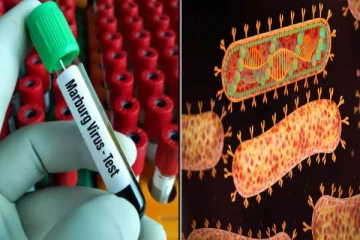 இந்த வைரஸ் தாக்கினால் கண்ணிலிருந்து ரத்தம் வருமாம்.. ஜாக்கிரதை