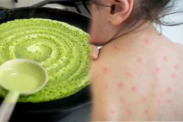 இந்த வெயில் காலத்தில் உடலில் ஏற்படும் புண்களுக்கு மருந்தாகும் மணத்தக்காளி தோசை!