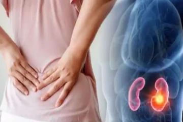 உங்களுக்கு கிட்னி பிரச்சனை இருக்கா? அப்போ இந்த உணவுகள ஒருபோதும் சாப்பிடவே சாப்பிடாதீங்க