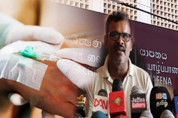 யாழில் எட்டு வயது சிறுமியின் கை அகற்றப்பட்ட விவகாரம்: முன்னாள் திடீர் மரண விசாரணை அதிகாரி குற்றச்சாட்டு