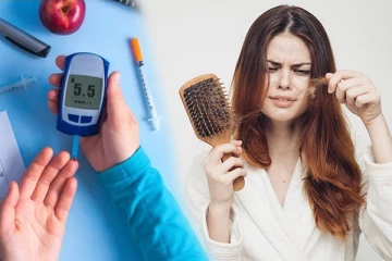 சக்கரை நோய் இருந்தால் முடி கொட்டுமா? உங்கள் குழப்பங்களுக்கான பதில் இதோ