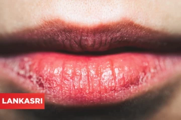 உதடு வெடிப்புக்கு தீர்வு வேண்டுமா? இதோ சில டிப்ஸ்