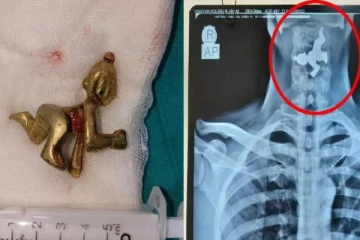 நபர் ஒருவர் வாயிலிருந்து வந்த கிருஷ்ணர் சிலை! நடந்தது என்ன? தலைசுற்றவைக்கும் பகீர் சம்பவம்