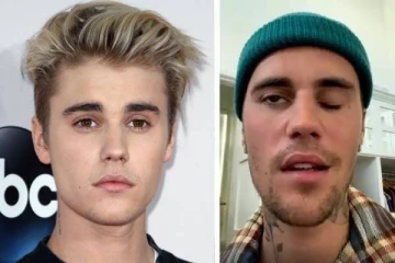 “ஒரு பக்க முகம் செயலிழந்துவிட்டது !” - மோசமான நோயால் பாதிக்கப்பட்ட ஜஸ்டின் பீபர்..