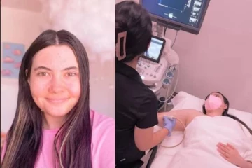 தண்ணீரால் அலர்ஜி: அரிய வகை நோயினால் பாதிக்கப்பட்டுள்ள பெண்