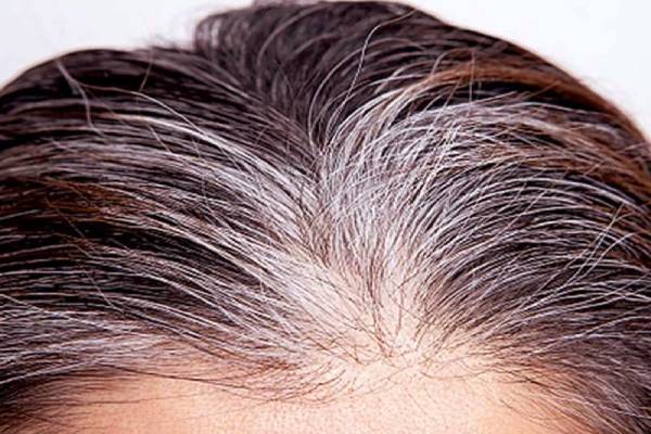 வெள்ளை முடியை நிரந்தரமாக கருப்பா மாற்ற இதை விட சிறந்த வழி இல்லை - என்ன தெரியுமா? | Solution To Permanently Turn White Hair Black வெள்ளை முடியை நிரந்தரமாக கருப்பா மாற்ற இதை விட சிறந்த வழி இல்லை - என்ன தெரியுமா? | Solution To Permanently Turn White Hair Black