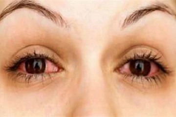 ඇස් කෙවෙන්නේ ඇත්තටම දුකක් කරදරයක් නිසාද මෙන්න හේතුව..